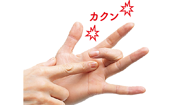 大阪切らないばね指手術